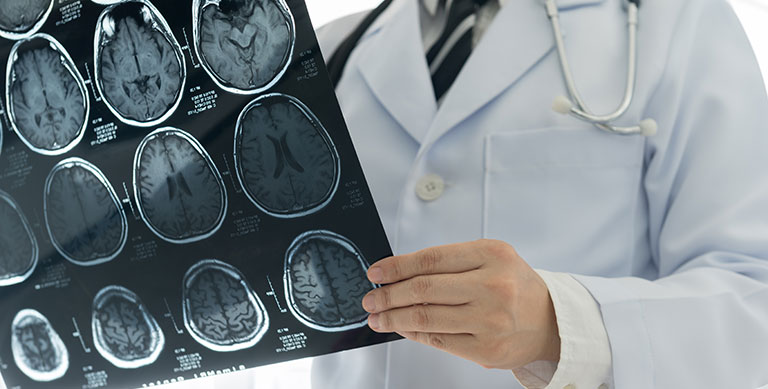 doctor holding brain mri